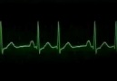 Ekg Ritimleri II [Bir Bir İki - 112]