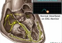 Kalbin İleti Sistemi - Medikal Paylaşım [HQ]