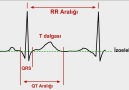 Normal EKG dalgaları [HQ]