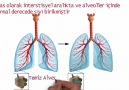 Akut Akciğer Ödemi - EKG ve Güncel Protokoller