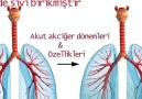Akut Akciğer ÖdemiTürkçe Anlatım KaynakBilim Sağlık