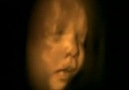 Amazing Footage of Life in the Womb