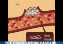 Anticoagulant dyring dialysis