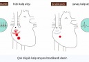 Aritmi Nedir ? - EKG ve Güncel Protokoller