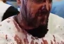 Aşuradan sonra Cnubi Azrbaycanlı şilrin durumu.Allah hidayt elsin !
