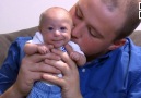 Baby Boy Has Rare Form Of Dwarfism