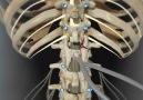 Back Surgery Posterior Lumbar Fusion