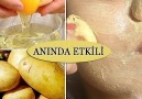 Becerikli Hatun - ANINDA YÜZ BEYAZLATMA