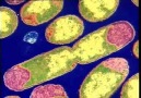 Binary fission in E.coli