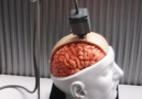 Brain implant boosts human memory by up to 30%.