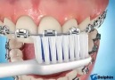 Brushing Techniques with Braces.