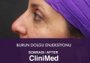 BURUN DOLGU ENJEKSİYONU