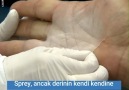 Bu sprey yanık deriyi kaplayarak iyileştiriyor