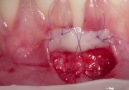 challenge case