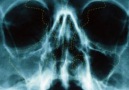 Check out how surgeons deal with sinus infection.