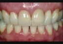 Cosmetic Dentistry