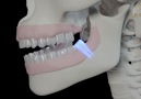 Dentaport Dental Klinik - Diş iltihabı Facebook