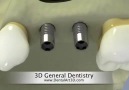 3D General Dentistry in 4 minutes