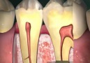 Diş Anatomisi  -  Tooth Anatomy