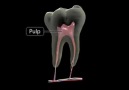 Diş Apsesi -3D Anatomi Video
