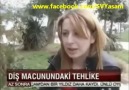 DİŞ MACUNLARIDAKİ TEHLİKE FLORİD