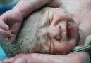 Doctors revive this baby born in a Syria bombing!