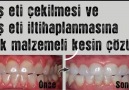 Doğal Reçete - Diş eti çekilmesi ve diş eti iltihaplanmasına tek malzemeli çözüm