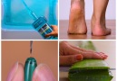8 easy remedies you can try at home!