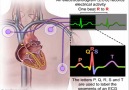 EKG - 2 (Medikal Paylaşım) paylaşınız...