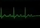 Elektrokardiyografi Ritimler - EKG ve Güncel Protokoller