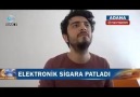 Elektronik sigarası patlayan Adanalı.
