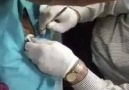 Erkan Söğüt - Ali paşayı kestirdik zorda olsa bitti