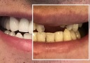 Estetium Life - Estetik sağlıklı ve doğal dişler ile...