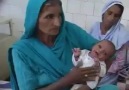 Evrimden arta kalanlar: Pakistanlı Bebek Bir Kuyruğa Sahip