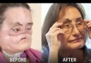 Face transplants are getting better and better! credit Hashem Al-Ghaili