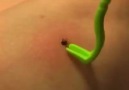Get Ticks Off You or Your Pet