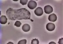 Globulo bianco (neutrofilo) insegue un batterio