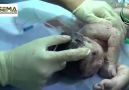 Halep'te doğmamış bebek şarapnel parçasıyla yaralandı