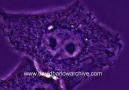 HeLa (kanser) hücresinin bölünmesi