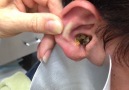 He straight up had a turd in his ear