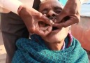Hindistan' da Takma Diş Operasyonu