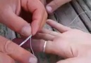How to remove a jammed ring from your finger