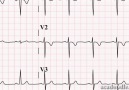 Improve your ECG skills -