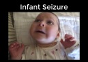 Infant Seizure...