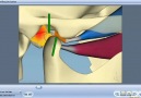 Interesting animation about TMJ disorders.