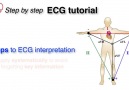 Introduction and Approach to ECG
