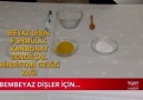 İşte doğal yollarla dişleri beyazlatmanın formülü