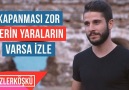 Kapanması Zor Derin Yaraların Varsa İzle !