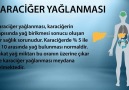 KARACİĞER YAĞLANMASININ BELİRTİLERİLütfen Paylaşalım