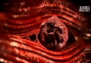 Kas yiyen kurt: Trichinella spiralis